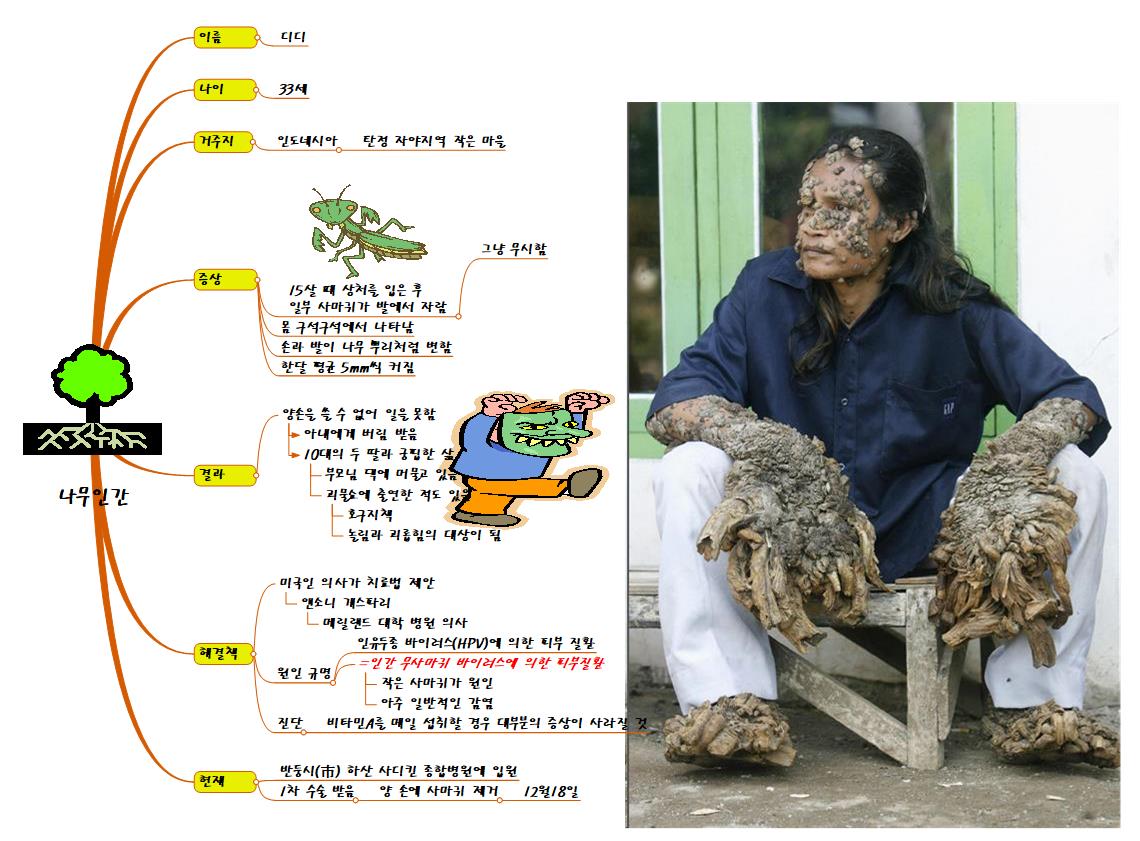 나무인간 이미지